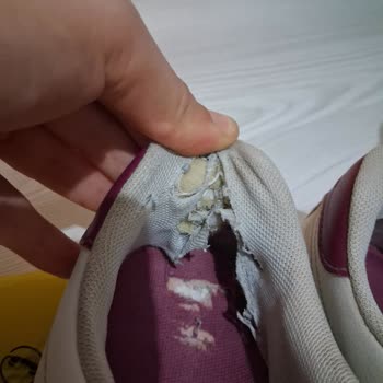Kısa Sürede Yırtılan Ayakkabının Garantisi Reddedildi, İade Talebim