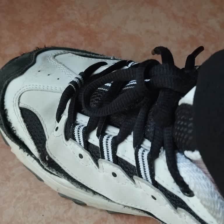 Altı Bin Liralık Skechers Ayakkabısında Dikiş Patlaması Ve İç Taban Yırtılması