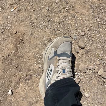 Skechers Ayakkabım 1 Ayda Yırtıldı, Değişim İstemime Müşteri Hatası Dedi