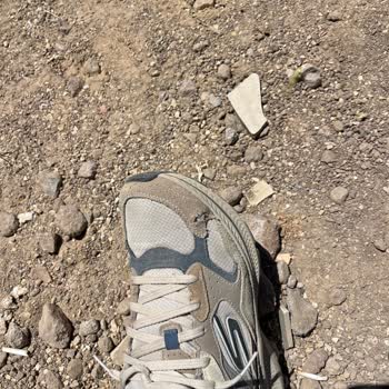 Skechers Ayakkabım 1 Ayda Yırtıldı, Değişim İstemime Müşteri Hatası Dedi