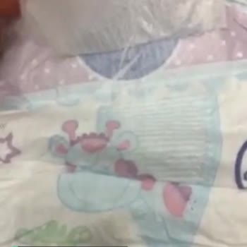 Molfix Bezde Çıkan Saçma Sapan Parçalar