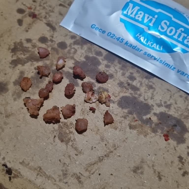 Halkalı Şubesinde Lahmacun Kalitesizliği Ve Sağlık Riski