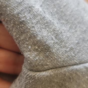 Kısa Sürede Aşırı Tüylenme Yaşanan Reebok Eşofman Altı İçin İade Talebi