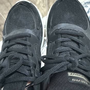 Skechers Ayakkabısında Dikiş Açılması Ve Kalite Şikayeti