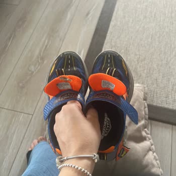 Skechers Çocuk Ayakkabısı 2 Ayda Açıldı Ve Yırtıldı, Değişim Talebim Cevapsız