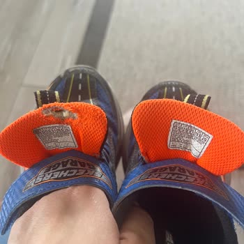 Skechers Çocuk Ayakkabısı 2 Ayda Açıldı Ve Yırtıldı, Değişim Talebim Cevapsız