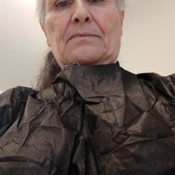 Göğüs Asimetrisi Ve Şekil Bozukluğu Nedeniyle Hastane İhmali Üzerine Tazminat Talebi