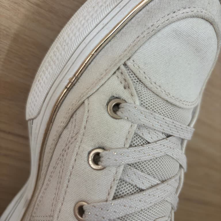 Skechers Ayakkabısında Kısa Sürede Açılan Bağcık Sorunu Ve Ücretsiz Değişim Talebi