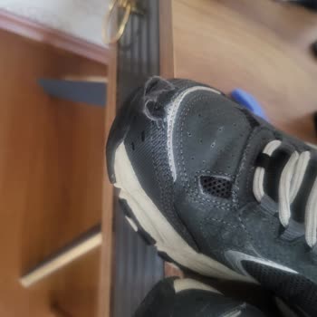 Skechers Ayakkabısında Dikiş Sorunu Ve Kullanıcı Hatası İddiası Reddedildi