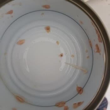 Ton Balığındaki Kılçık Damağa Batarak Fiziksel Ve Psikolojik Mağduriyet Yarattı