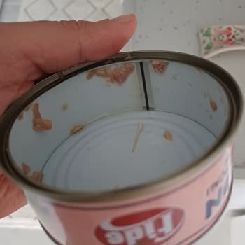 Ton Balığındaki Kılçık Damağa Batarak Fiziksel Ve Psikolojik Mağduriyet Yarattı