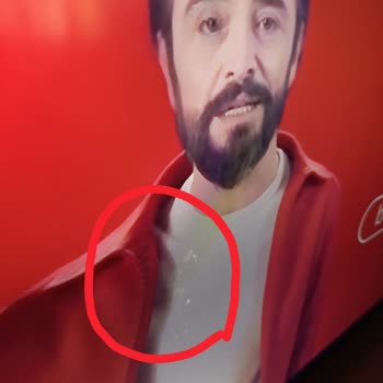 Garanti Süresinde TCL Televizyon Ekranındaki Lekeler ve Yetkisiz Servis Şikayeti