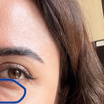 Luxen Wellness Clinic Memnun Kalmadığım Gibi Sorunlarım Da Düzeltilmedi