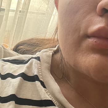 Luxen Wellness Clinic Memnun Kalmadığım Gibi Sorunlarım Da Düzeltilmedi
