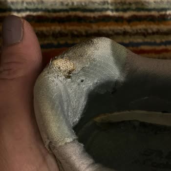 Skechers Ayakkabısının 6 Ayda Yırtılması Ve İade Talebi