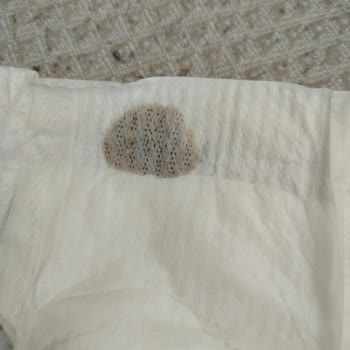 Molfix Ultra Advantage Bezinde Sızdırma Ve Yabancı Madde: Hijyen Endişesi