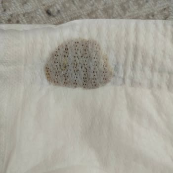 Molfix Ultra Advantage Bezinde Sızdırma Ve Yabancı Madde: Hijyen Endişesi