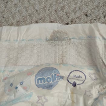 Molfix Ultra Advantage Bezinde Sızdırma Ve Yabancı Madde: Hijyen Endişesi