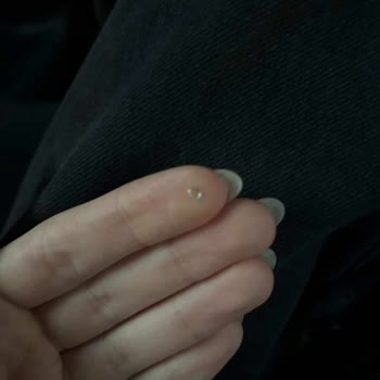 Vivident Sakızında Metal Parça Çıktı Şirketten Hızlı İnceleme Ve Sorumluluk Talebi