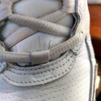 Skechers Ayakkabısında Deformasyon, Fotoğrafla Kanıtlanmasına Rağmen Talep Reddedildi