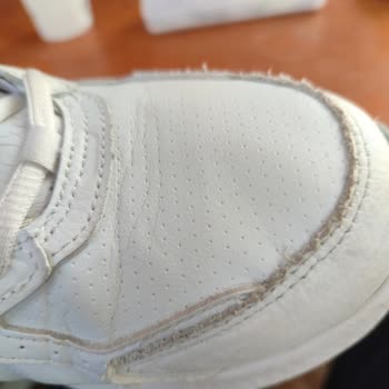 Skechers Ayakkabısında Deformasyon, Fotoğrafla Kanıtlanmasına Rağmen Talep Reddedildi