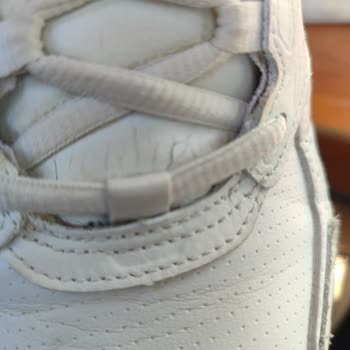 Skechers Ayakkabısında Deformasyon, Fotoğrafla Kanıtlanmasına Rağmen Talep Reddedildi