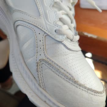 Skechers Ayakkabısında Deformasyon, Fotoğrafla Kanıtlanmasına Rağmen Talep Reddedildi