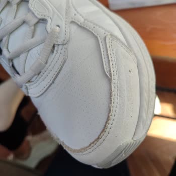 Skechers Ayakkabısında Deformasyon, Fotoğrafla Kanıtlanmasına Rağmen Talep Reddedildi