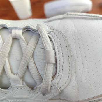 Skechers Ayakkabısında Deformasyon, Fotoğrafla Kanıtlanmasına Rağmen Talep Reddedildi