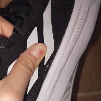 Adidas Ayakkabısındaki Açılma Sorunu Ve Mağaza İlgisizliği