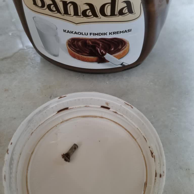 Torku Çikolata Kavanozunda Vida Çıktı Ve Diş Dolgusu Kırıldı