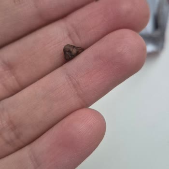 Kahve Dünyası Çikolatasında Taş Çıktı Dişim Neredeyse Kırıldı