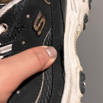Skechers Sneaker Ayakkabım 6 Ayda Tabandan Açılma Ve Üretim Hatası