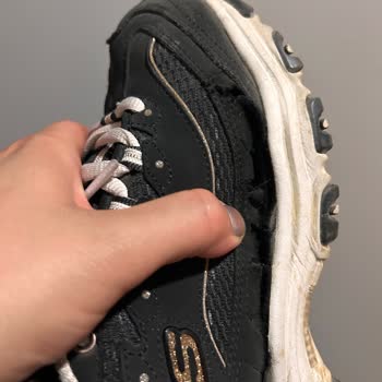 Skechers Sneaker Ayakkabım 6 Ayda Tabandan Açılma Ve Üretim Hatası