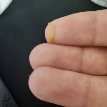 Dönerde Tırnak Bulunması, Hijyen İhlali Ve İade Talebi