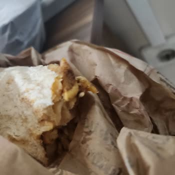 Dönerde Tırnak Bulunması, Hijyen İhlali Ve İade Talebi