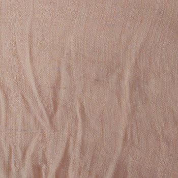 Deforme Ürün Ve Kargo Sorunları Nedeniyle İade Talebimin Reddedilmesi