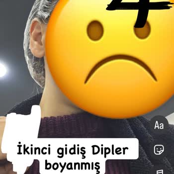 Saç Diplerine Renk Sürülerek Yanlış Ombre Ve Yıpranan Saçlar İçin 7.000 TL İadesi Talebi