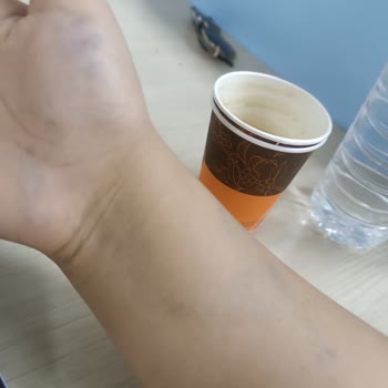 Dalga Su Şişelerinin Ambalaj Boyası Kıyafete Ve Elden Bulaşıyor