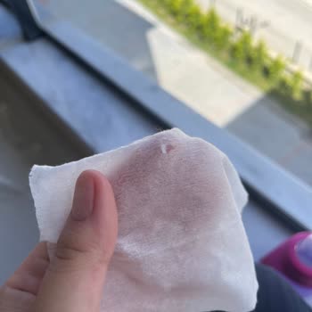 Bebek Mendilinde Plastik Parça Ve Pişik: Güvenlik Endişesi