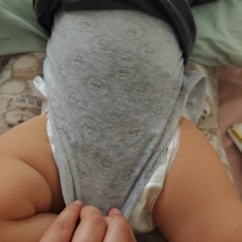Molfix Bebek Bezinde Şiddetli Sızdırma Ve Ücret İadesi Talebi