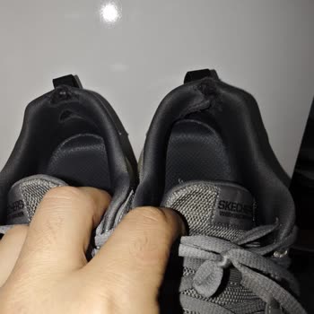 Skechers Ayakkabısında 2 Hafta İçinde Topuk Yırtılması, Kullanıcı Hatası İddiası Ve Değişim Talebi