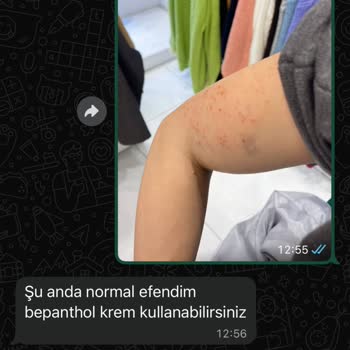 Bağcılar Şubesinde Lazer İşlemi Kalitesiz Ve İlgisiz, Ücret İadesi Talebi
