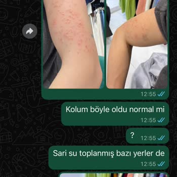Bağcılar Şubesinde Lazer İşlemi Kalitesiz Ve İlgisiz, Ücret İadesi Talebi