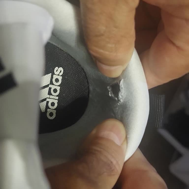 Adidas Ayakkabısında Tekrarlayan İç Aşınma Ve Garanti Dışı Sorun