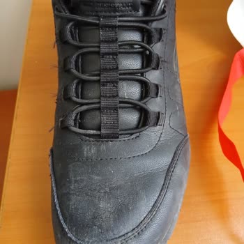 Skechers Ayakkabısının Deri Dökülmesi Ve Üretim Hatası Reddi Sonrası Değişim Talebi