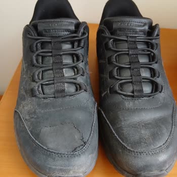 Skechers Ayakkabısının Deri Dökülmesi Ve Üretim Hatası Reddi Sonrası Değişim Talebi
