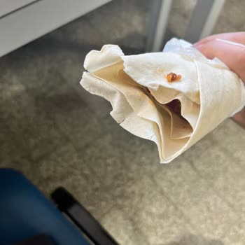 Kalitesiz Ve Eksik Sipariş, Fotoğraf Yükleyememe Nedeniyle İade Talebi
