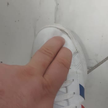 Adidas Ayakkabısının 6 Günlük Kullanımda Deforme Olması Ve İade Reddi