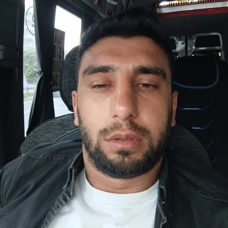 E'liva Beauty (Diyarbakır) Dermapen Sonrası Şiddetli Yan Etki ve Aşırı Ücret